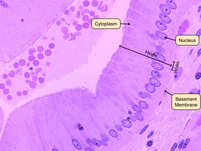 Simple squamous epithelium slide 400x