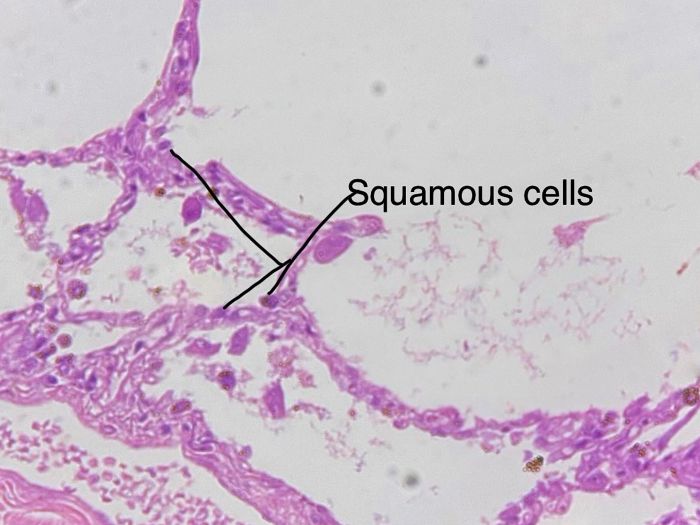 Microscope histology under squamous simple epithelium human slides anatomy pay reddit