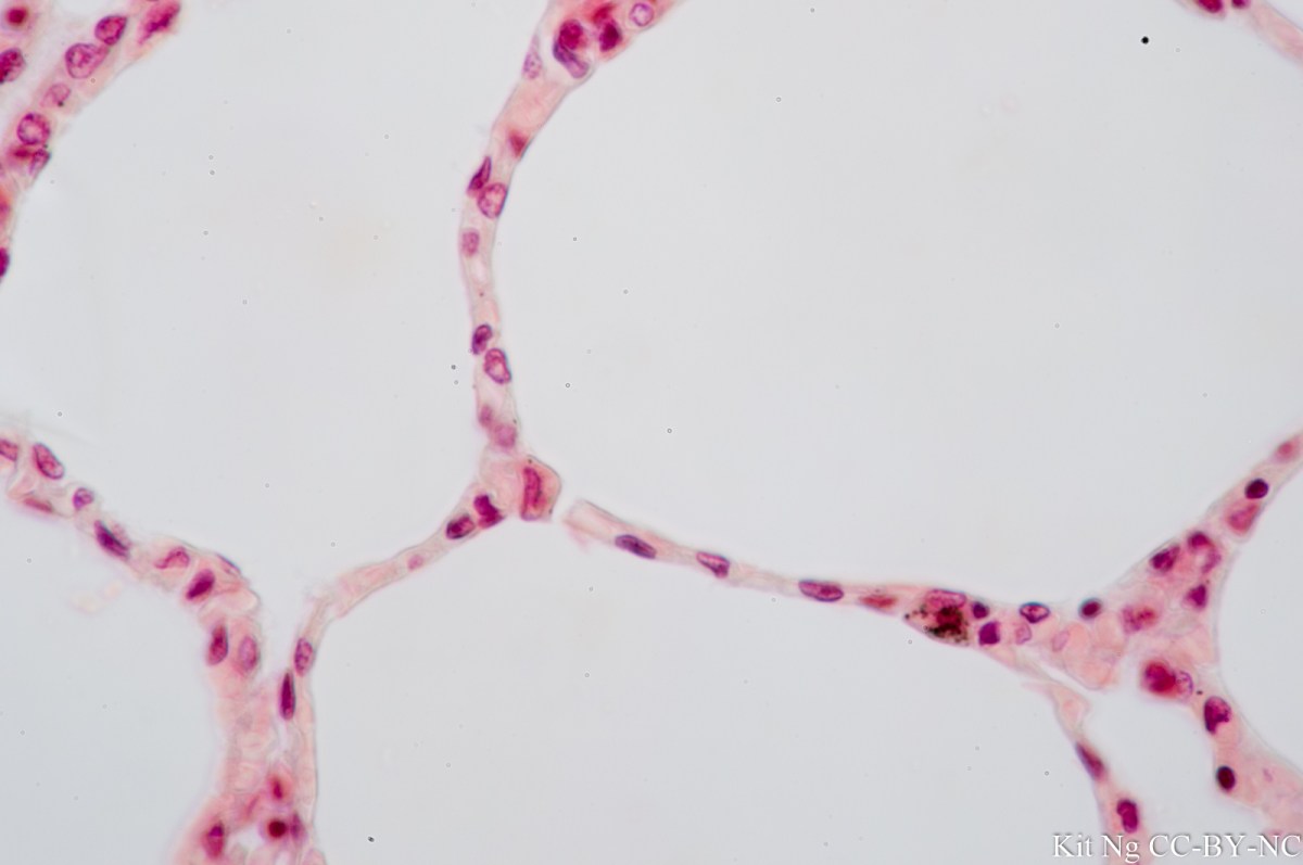 Simple squamous epithelium slide 400x