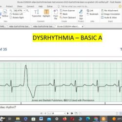 Relias dysrhythmia basic a test answers course hero